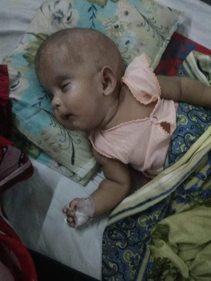 ২ মাস বয়সের আব্দুর রহমানের চিকিৎসার জন্যে সাহায্য প্রয়োজন (CF-0038)