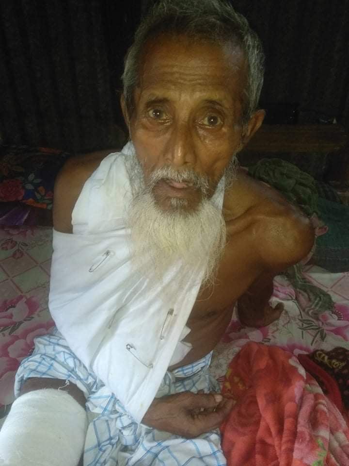 অস্বচ্ছল বৃদ্ধ মুরুব্বি শাহাবুদ্দিন খলিফার চিকিৎসার জন্যে ৪০ হাজার টাকা প্রয়োজন (CF-0047)